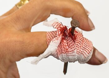 7 Effective Steps on How to Heal from Financial Trauma and Rebuild Your Life