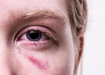 5 Signs You’re Experiencing Financial Trauma and How to Overcome It